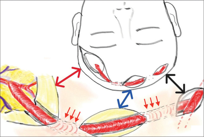 Figure 5: