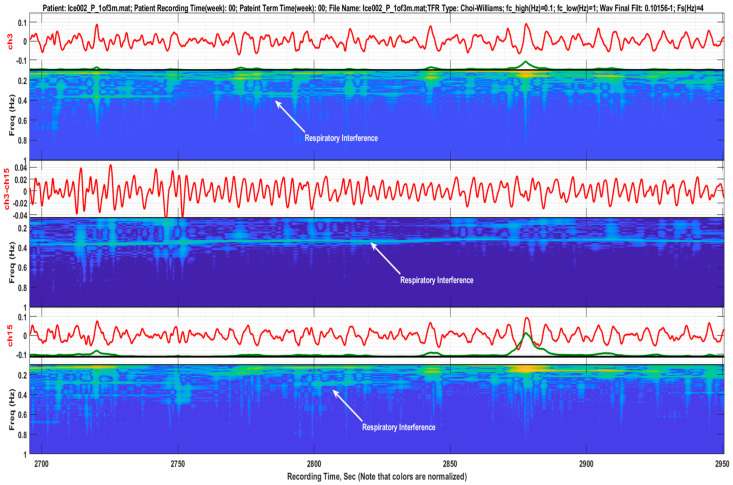 Figure 11