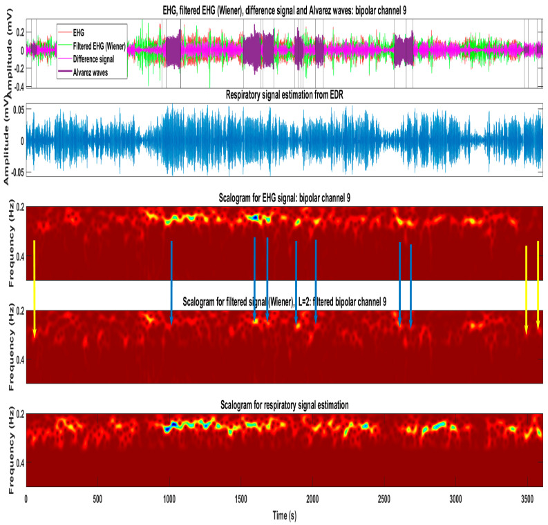 Figure 12