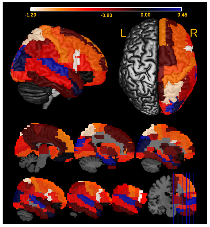 Figure 11