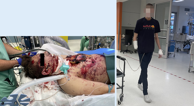 graphic file with name 101_2023_1307_Fig2_HTML.jpg