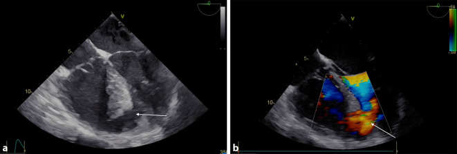graphic file with name 101_2023_1307_Fig1_HTML.jpg