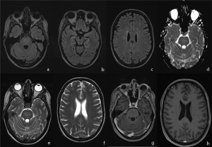 Fig. 6