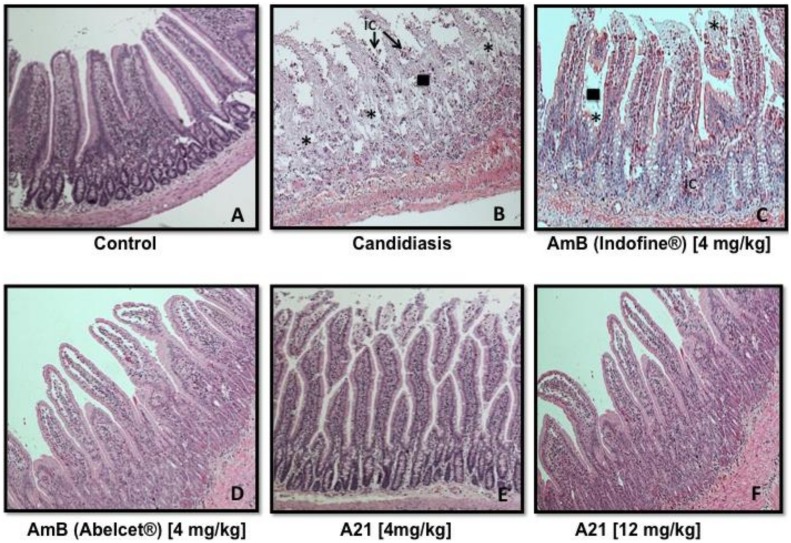 Fig 14