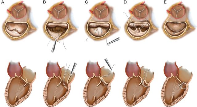 Figure 1: