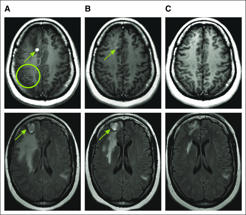 FIG 2.