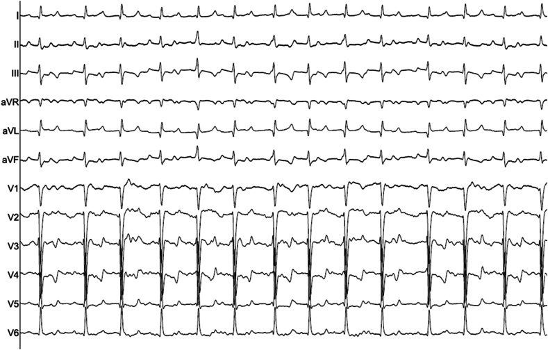 Fig. 5