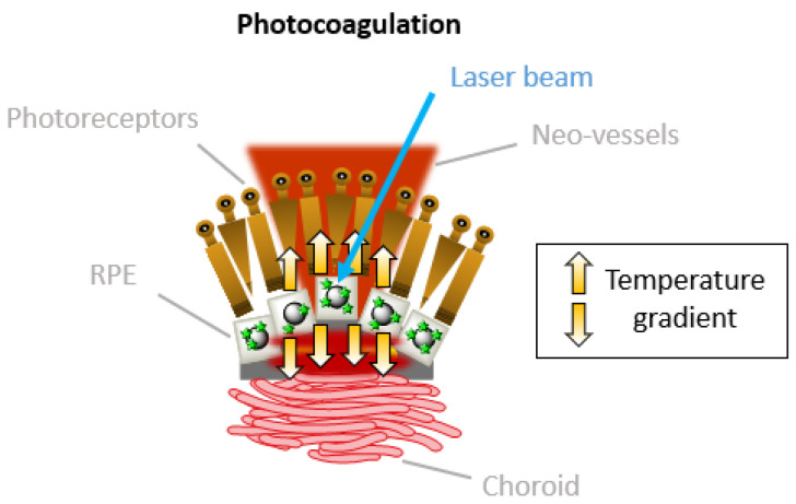 Figure 18