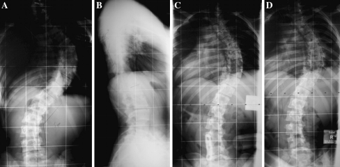 Fig. 2