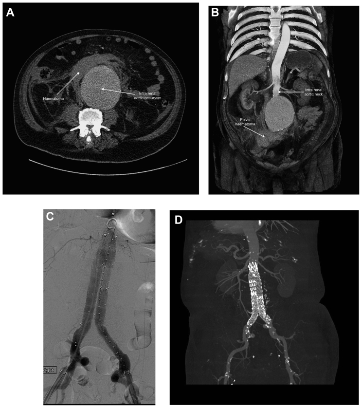 Fig 2