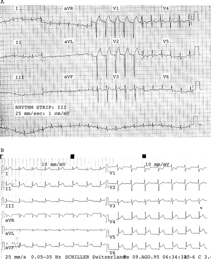 Figure 1  