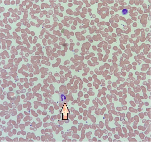 Fig. 2