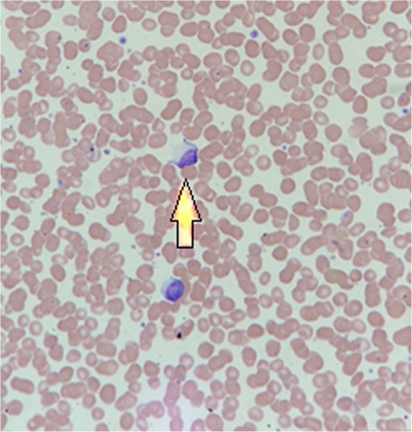 Fig. 1