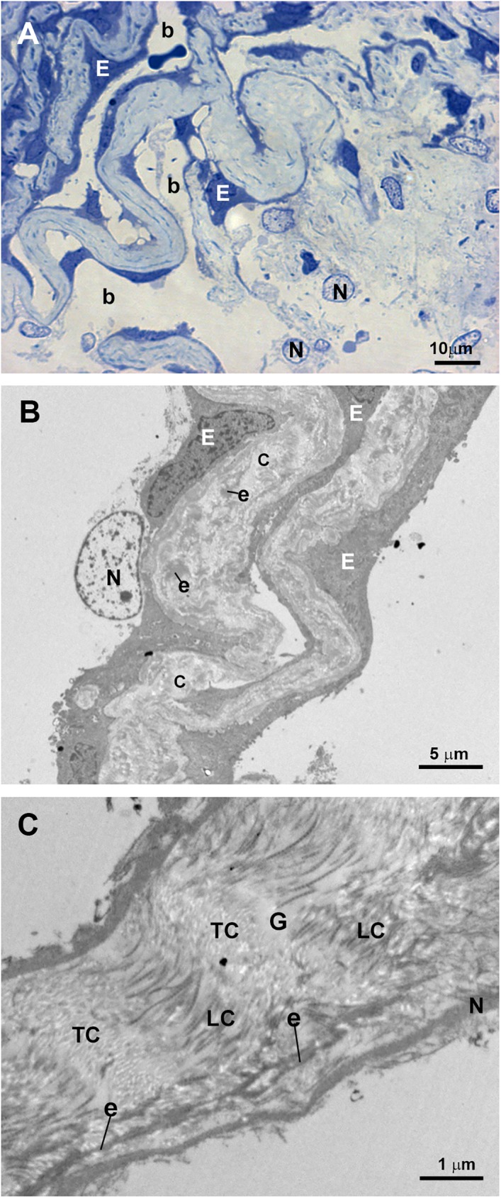 Fig 13