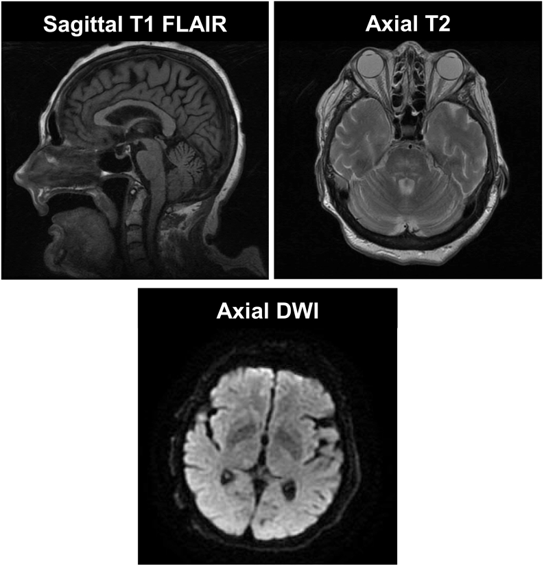 Fig. 3