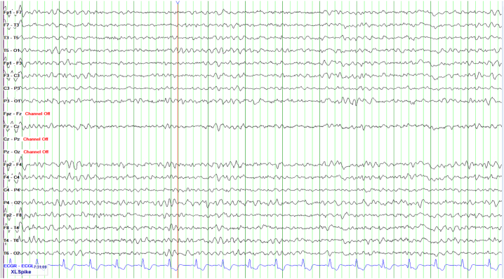 Fig. 2