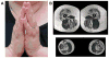 Fig. 1