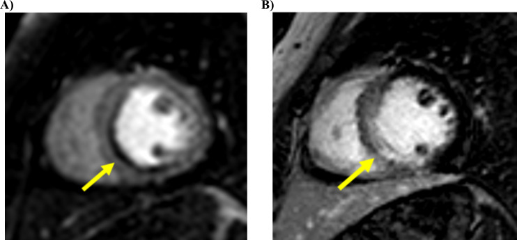 Fig. (3)