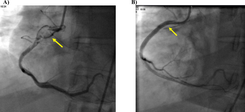 Fig. (2)