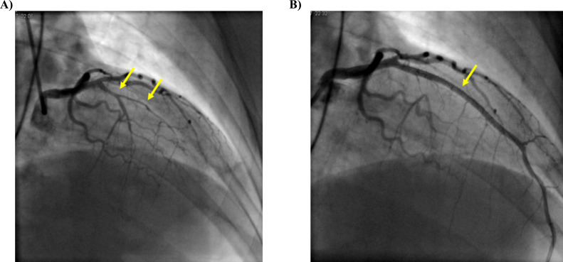 Fig. (1)