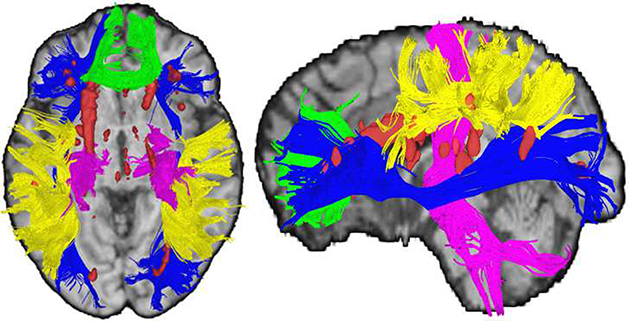 Figure 1: