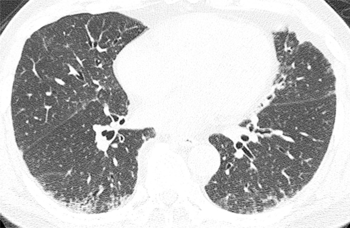 Figure b: