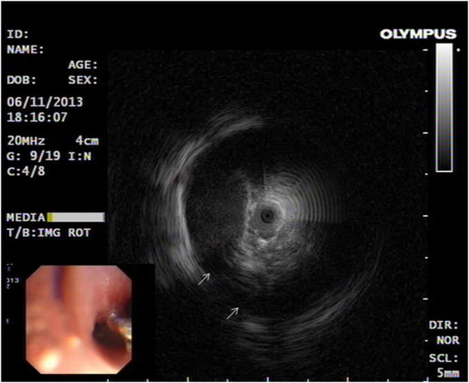 Fig. 3