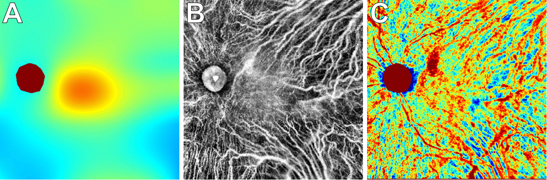 Figure 11.