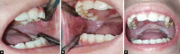 Figs 1A to C