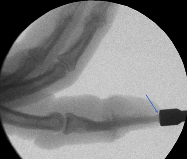 Fig. 2