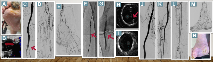 Figure 1