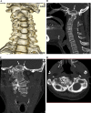 Fig. 1