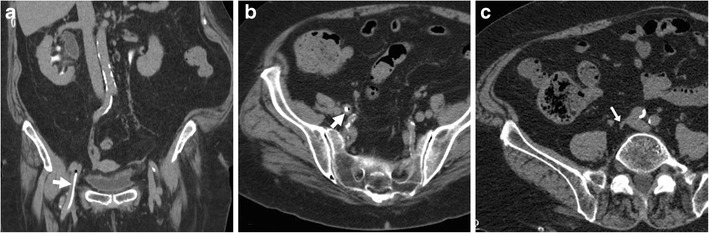 Fig. 12