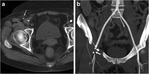 Fig. 8