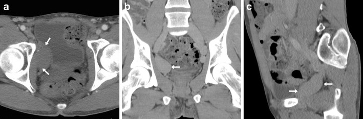 Fig. 13