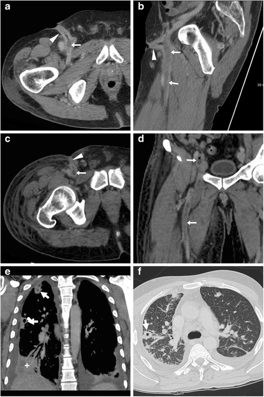 Fig. 11