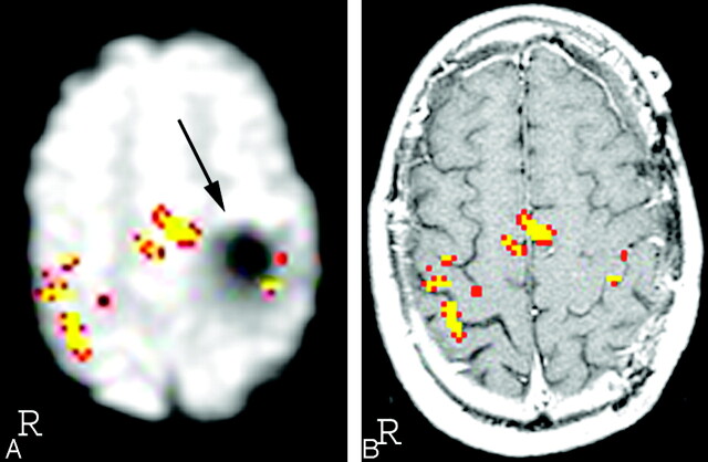 Fig 2.