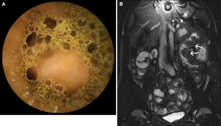 Fig. 3