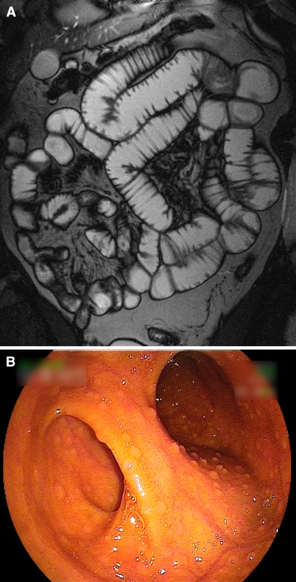 Fig. 4