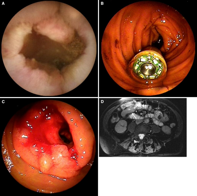 Fig. 1