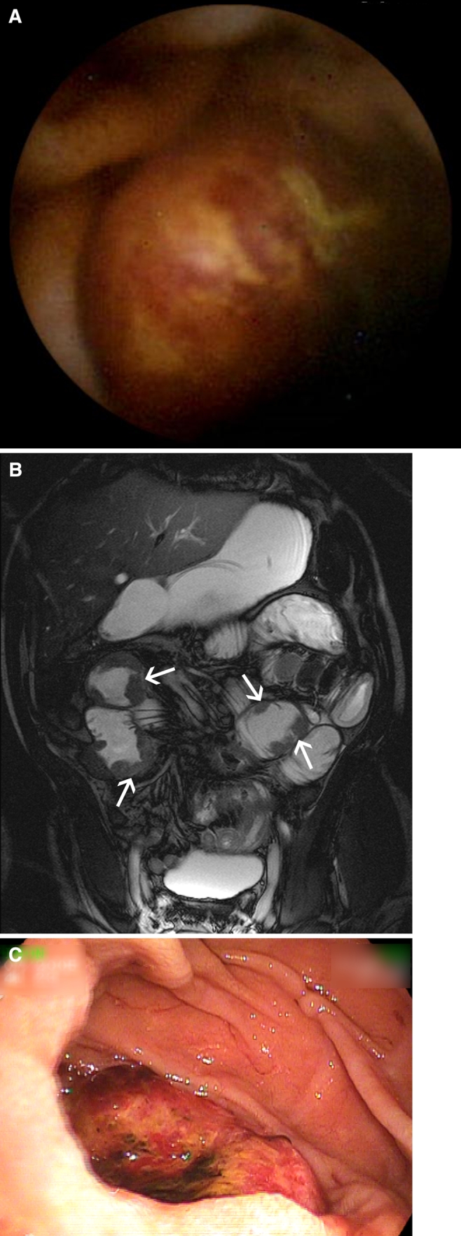 Fig. 2