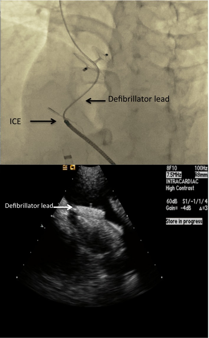 Figure 12