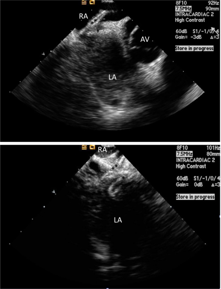 Figure 10