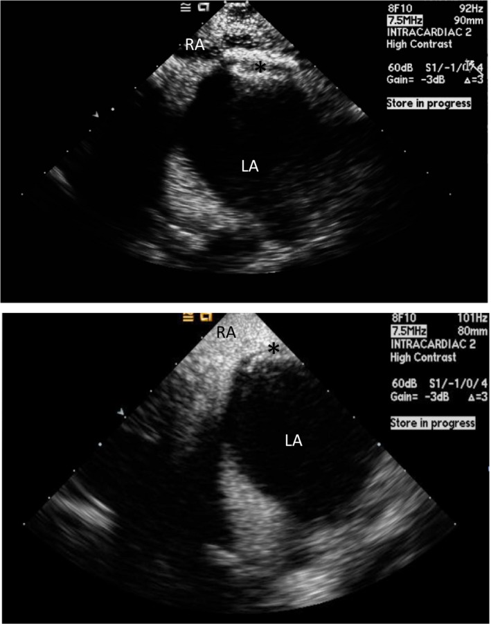 Figure 11