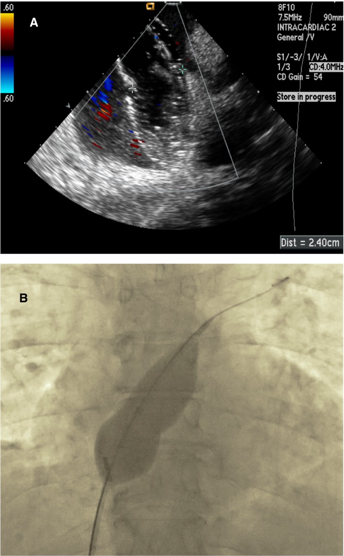 Figure 9