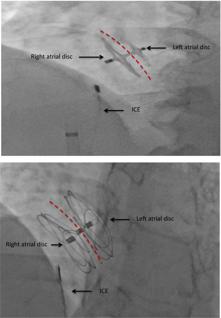 Figure 6