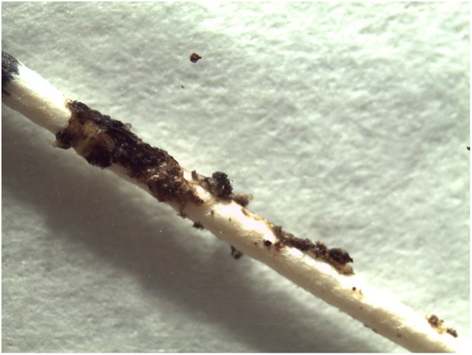 risk-factors-for-the-presence-of-dental-black-plaque-pmc