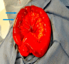 Fig. 3