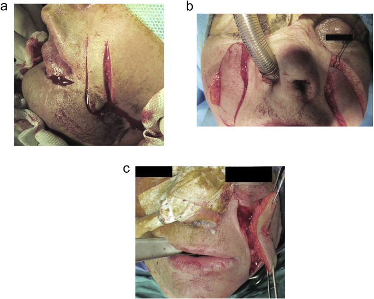 Fig. 2