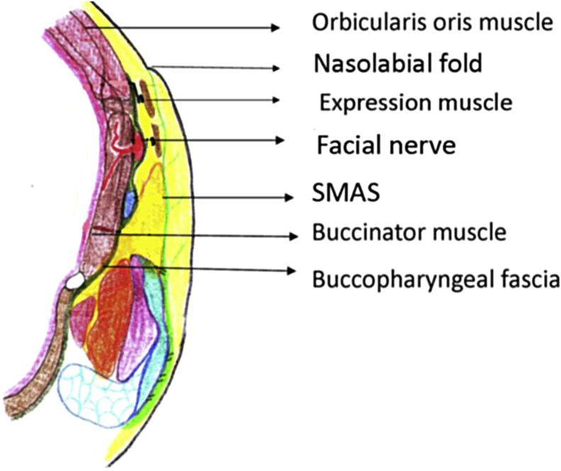 Fig. 1